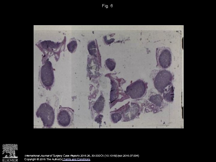 Fig. 6 International Journal of Surgery Case Reports 2016 26, 30 -33 DOI: (10.