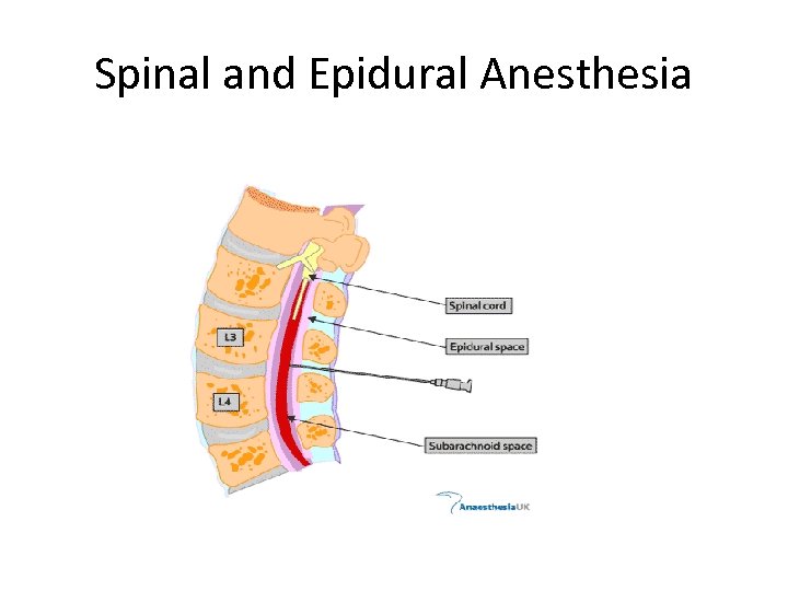 Spinal and Epidural Anesthesia 