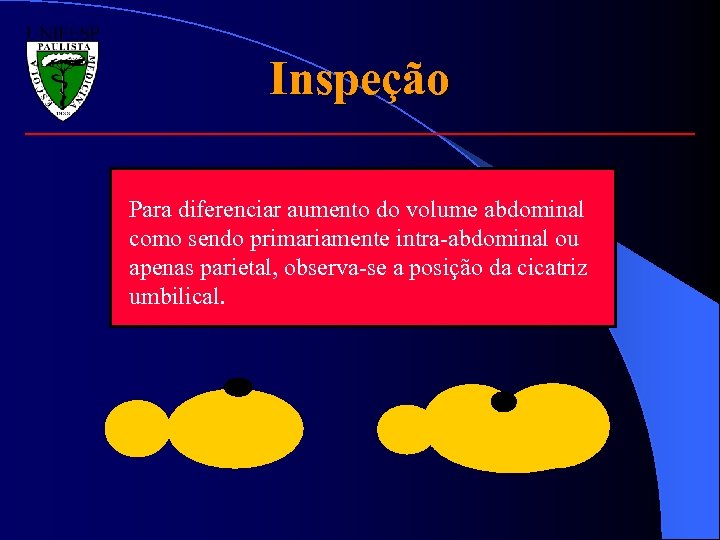 Inspeção Para diferenciar aumento do volume abdominal como sendo primariamente intra-abdominal ou apenas parietal,