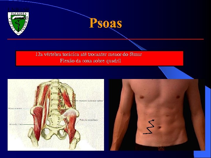 Psoas 12 a vértebra torácica até trocanter menor do fêmur Flexão da coxa sobre