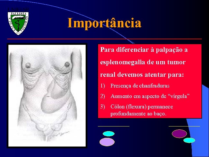 Importância Para diferenciar à palpação a esplenomegalia de um tumor renal devemos atentar para: