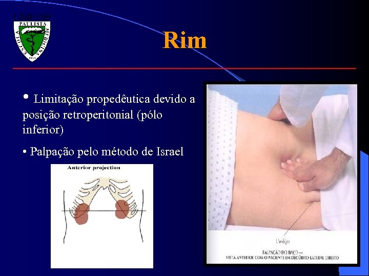 Rim • Limitação propedêutica devido a posição retroperitonial (pólo inferior) • Palpação pelo método