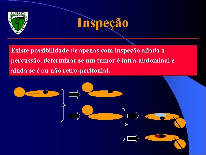 Inspeção Existe possibilidade de apenas com inspeção aliada à percussão, determinar se um tumor