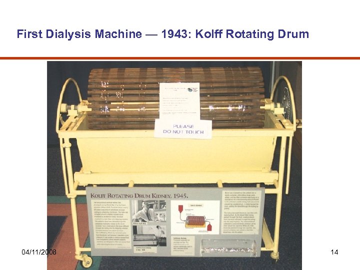 First Dialysis Machine — 1943: Kolff Rotating Drum 04/11/2008 14 
