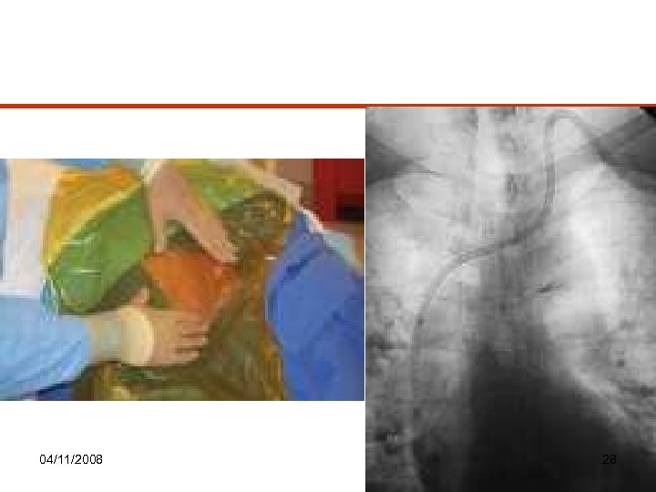 04/11/2008 28 
