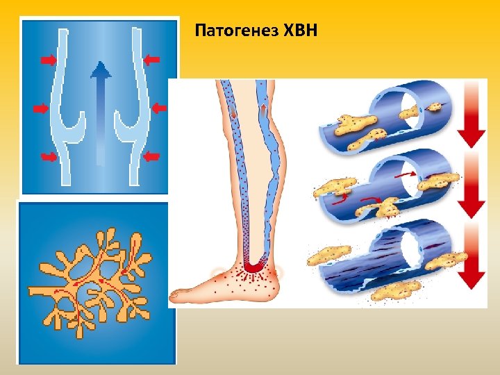 Патогенез ХВН 