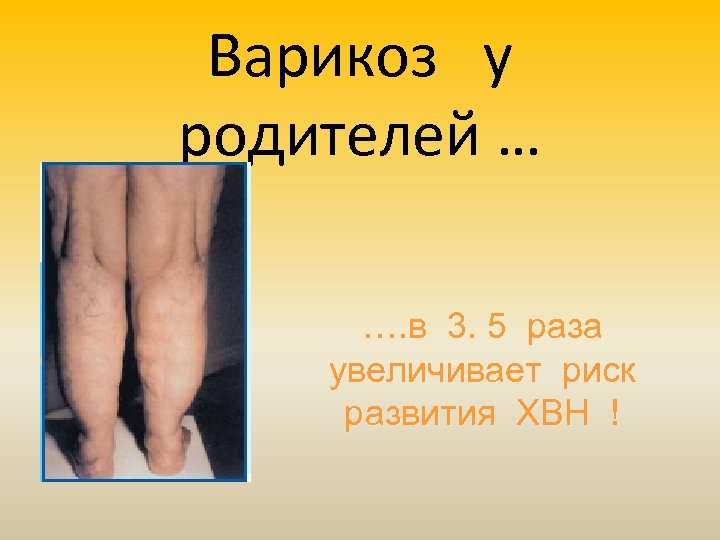 Варикоз у родителей … …. в 3. 5 раза увеличивает риск развития ХВН !