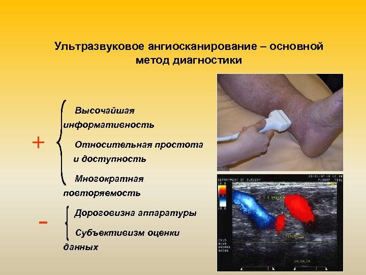 Ультразвуковое ангиосканирование – основной метод диагностики Высочайшая + информативность Относительная простота и доступность Многократная