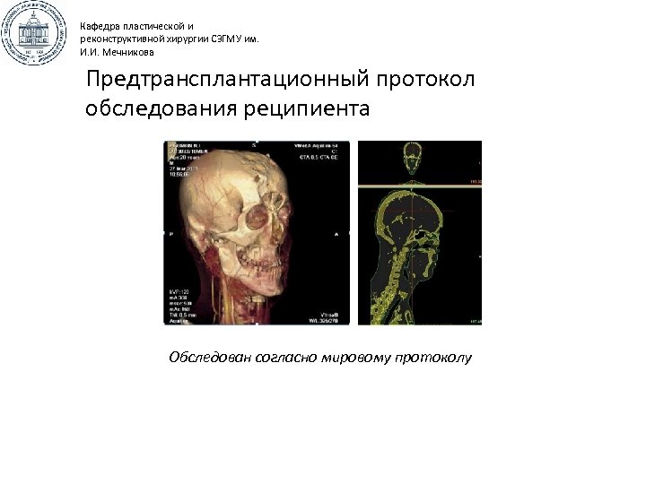 Кафедра пластической и реконструктивной хирургии СЗГМУ им. И. И. Мечникова Предтрансплантационный протокол обследования реципиента