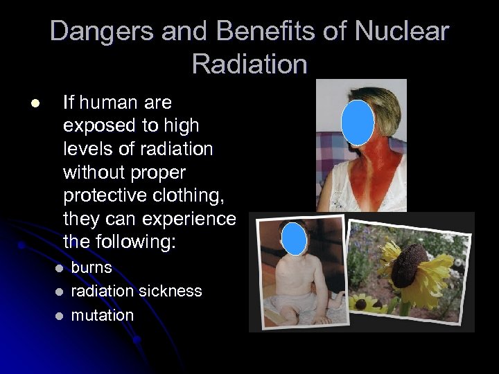 Dangers and Benefits of Nuclear Radiation l If human are exposed to high levels