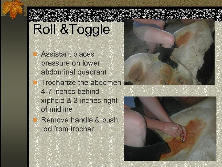 Roll &Toggle n Assistant places pressure on lower abdominal quadrant n Trocharize the abdomen