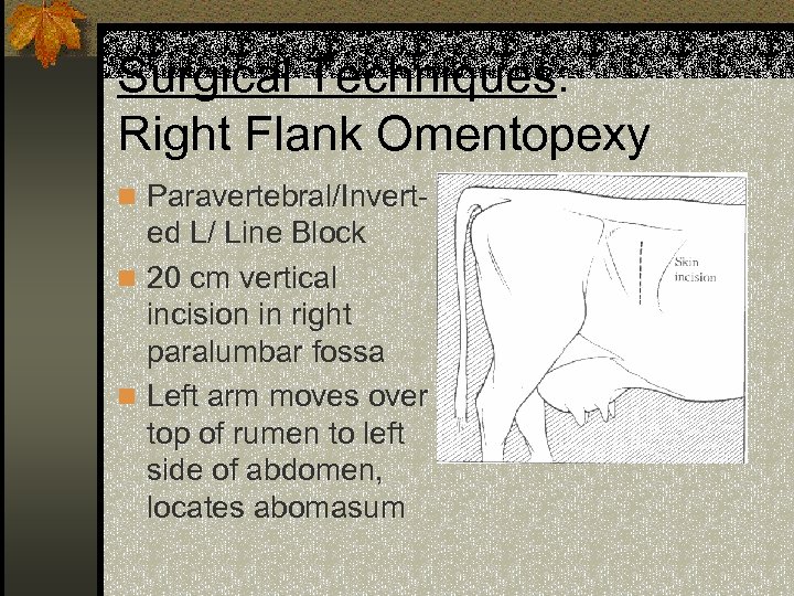 Surgical Techniques: Right Flank Omentopexy n Paravertebral/Invert- ed L/ Line Block n 20 cm