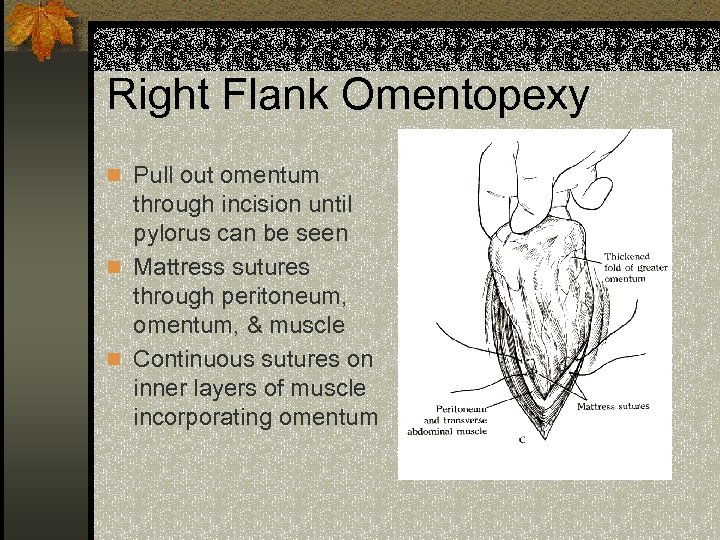 Right Flank Omentopexy n Pull out omentum through incision until pylorus can be seen