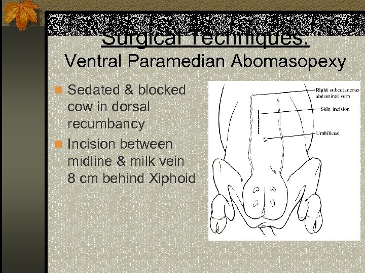 Surgical Techniques: Ventral Paramedian Abomasopexy n Sedated & blocked cow in dorsal recumbancy n