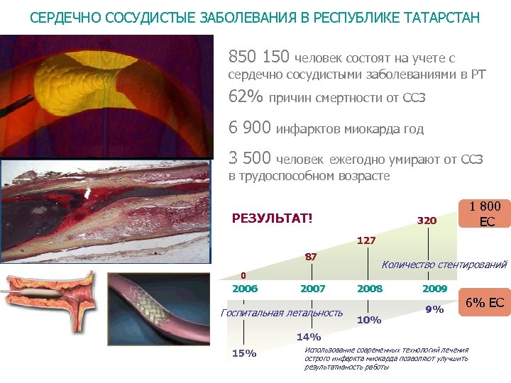 СЕРДЕЧНО СОСУДИСТЫЕ ЗАБОЛЕВАНИЯ В РЕСПУБЛИКЕ ТАТАРСТАН 850 150 человек состоят на учете с сердечно