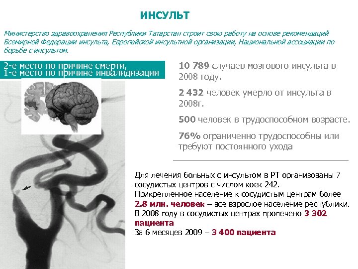 ИНСУЛЬТ Министерство здравоохранения Республики Татарстан строит свою работу на основе рекомендаций Всемирной Федерации инсульта,