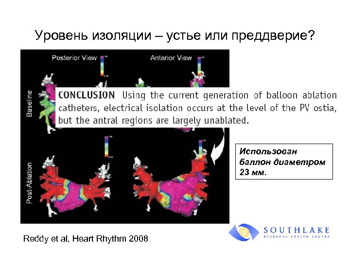 Уровень изоляции – устье или преддверие? Использован баллон диаметром 23 мм. Reddy et al,