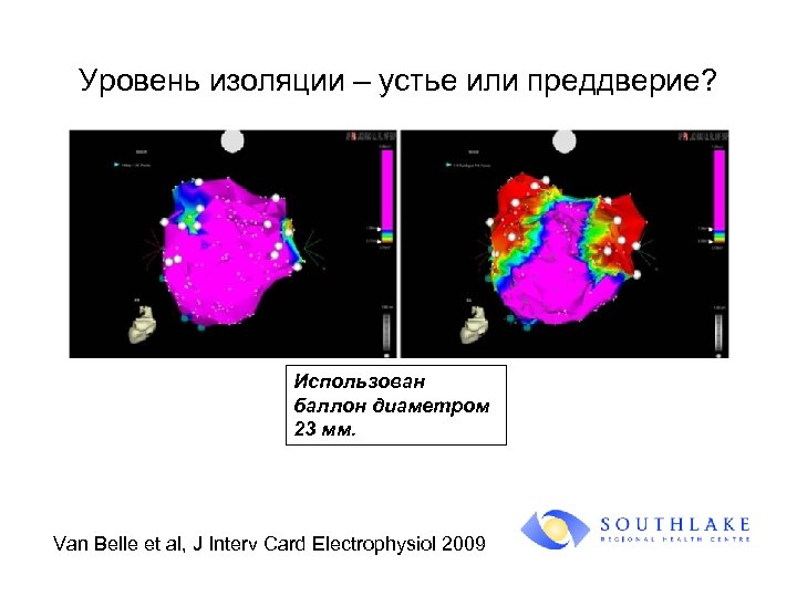 Уровень изоляции – устье или преддверие? Использован баллон диаметром 23 мм. Van Belle et