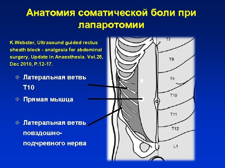 Анатомия соматической боли при лапаротомии K. Webster, Ultrasound guided rectus sheath block - analgesia