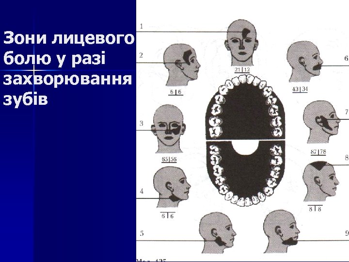 Зони лицевого болю у разі захворювання зубів 