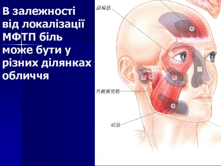 В залежності від локалізації МФТП біль може бути у різних ділянках обличчя 