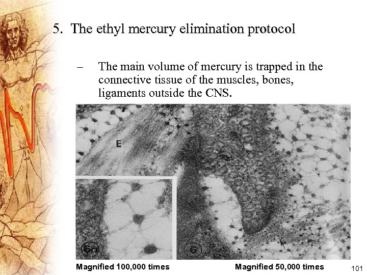 5. The ethyl mercury elimination protocol – The main volume of mercury is trapped