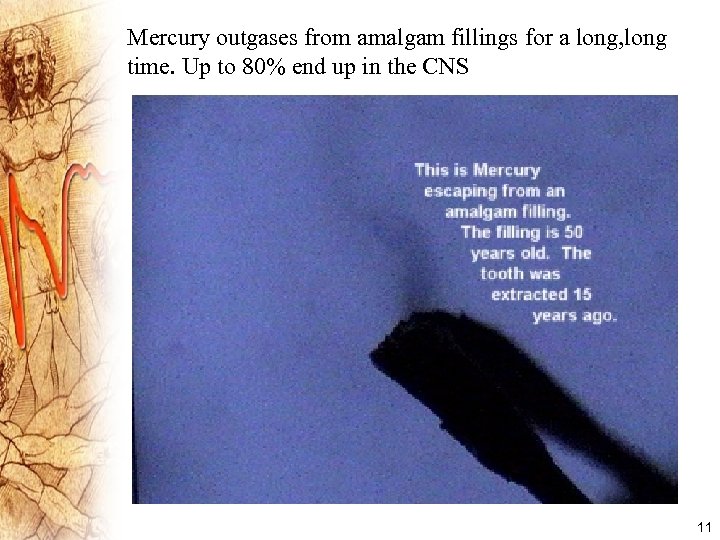 Mercury outgases from amalgam fillings for a long, long time. Up to 80% end