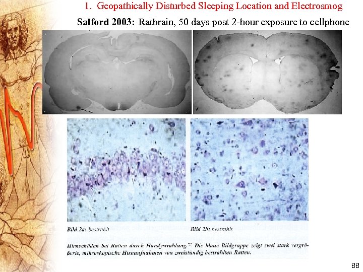1. Geopathically Disturbed Sleeping Location and Electrosmog Salford 2003: Ratbrain, 50 days post 2
