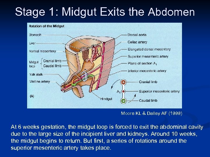 Stage 1: Midgut Exits the Abdomen Moore KL & Dalley AF (1999) At 6