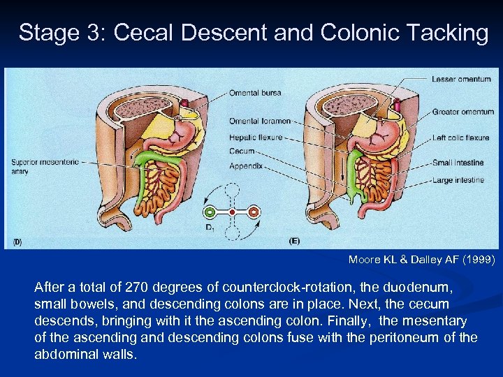 Stage 3: Cecal Descent and Colonic Tacking Moore KL & Dalley AF (1999) After