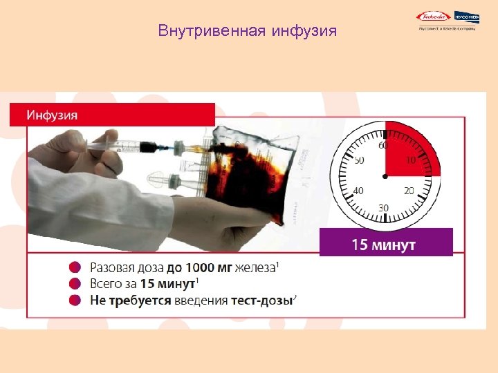 Внутривенная инфузия 