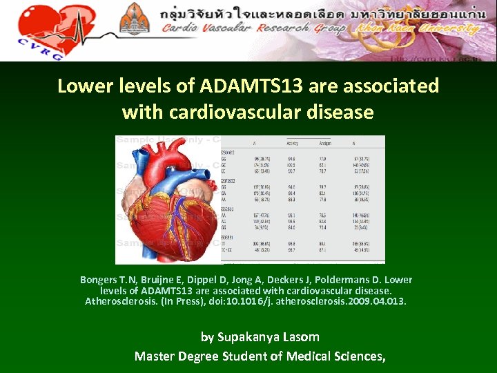 Lower levels of ADAMTS 13 are associated with cardiovascular disease Bongers T. N, Bruijne