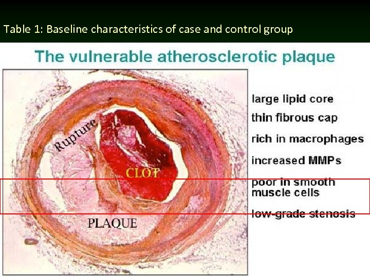 Atherosclerosis латынь