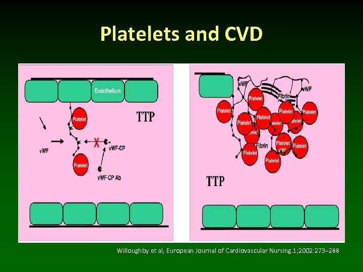 Platelets and CVD Willoughby et al, European Journal of Cardiovascular Nursing. 1; 2002: 273–