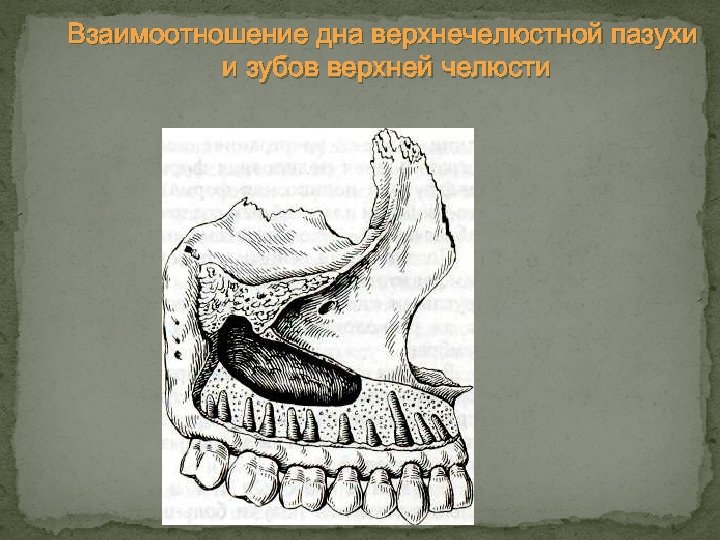 Гайморовы пазухи расположение схема рисунок и зубы