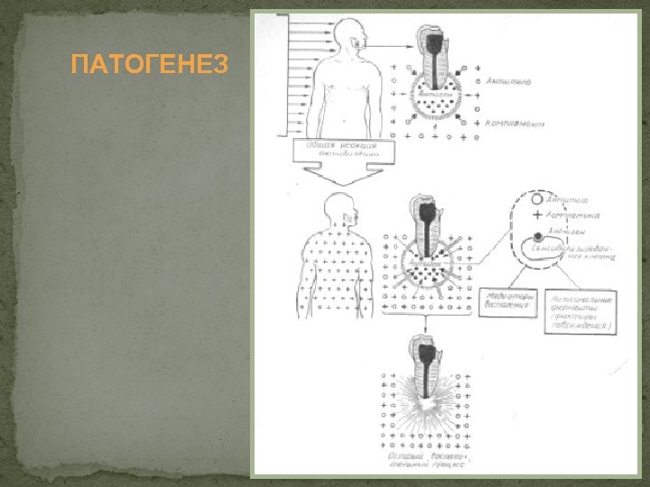 ПАТОГЕНЕЗ 