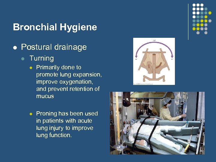 Bronchial Hygiene l Postural drainage l Turning l Primarily done to promote lung expansion,