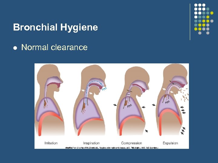 Bronchial Hygiene l Normal clearance 