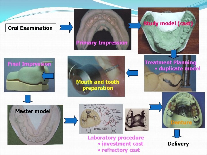 Study model (cast) Oral Examination Primary Impression Treatment Planning • duplicate model Final Impression