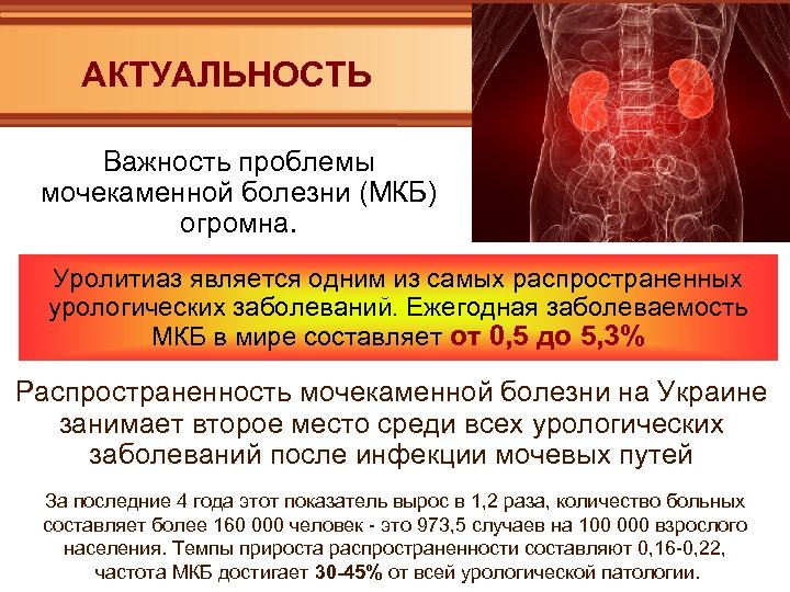 АКТУАЛЬНОСТЬ Важность проблемы мочекаменной болезни (МКБ) огромна. Уролитиаз является одним из самых распространенных урологических