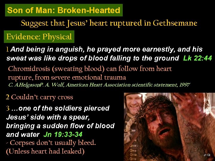 Son of Man: Broken-Hearted Suggest that Jesus’ heart ruptured in Gethsemane Evidence: Physical 1