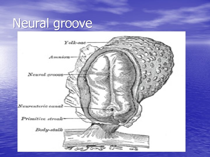 Neural groove 