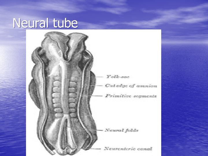 Neural tube 