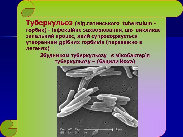 Туберкульоз (від латинського tuberculum - горбик) - інфекційне захворювання, що викликає запальний процес, який
