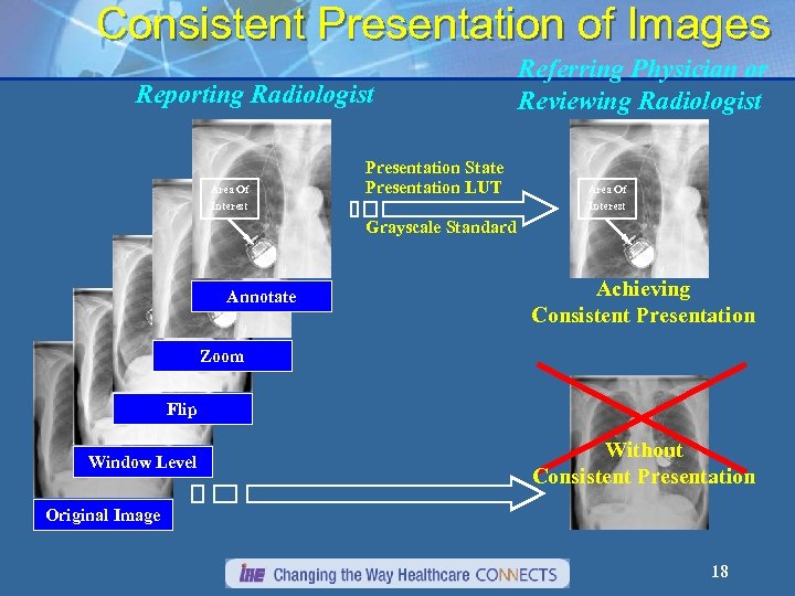 Consistent Presentation of Images Reporting Radiologist Area Of Interest Presentation State Presentation LUT Referring