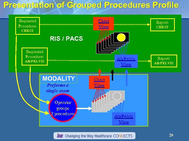 Presentation of Grouped Procedures Profile Chest View Requested Procedure: CHEST Report: CHEST RIS /