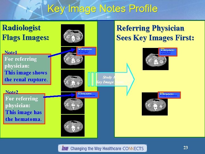 Key Image Notes Profile Radiologist Flags Images: Note 1 Referring Physician Sees Key Images