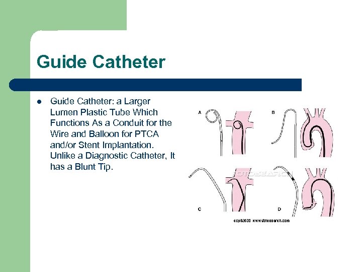 Guide Catheter l Guide Catheter: a Larger Lumen Plastic Tube Which Functions As a
