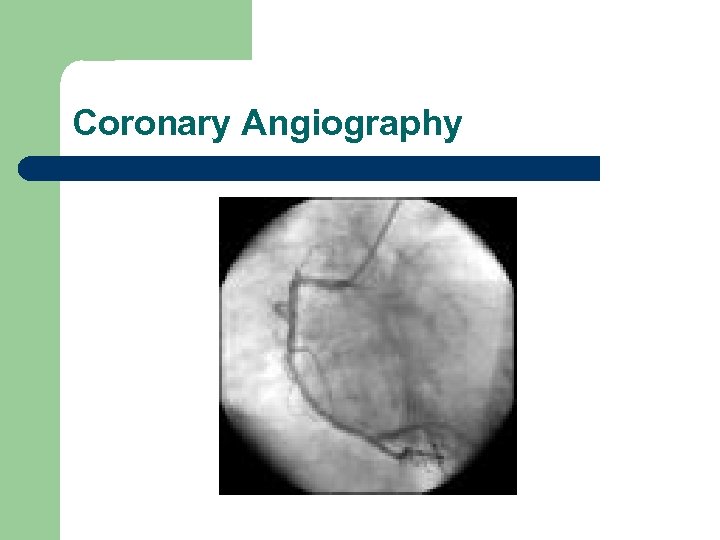 Coronary Angiography 