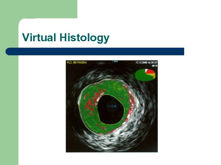 Virtual Histology 